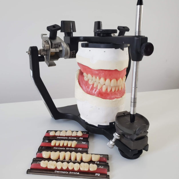 Simulateur 3D - Hanau Modular Articulator System - WhipMix